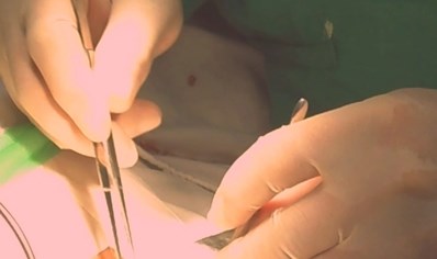 Phẩu thuật cột sống