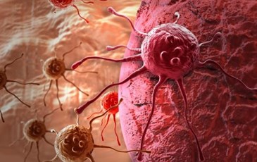 Lý do khiến việc dùng thuốc chữa ung thư không có kết quả